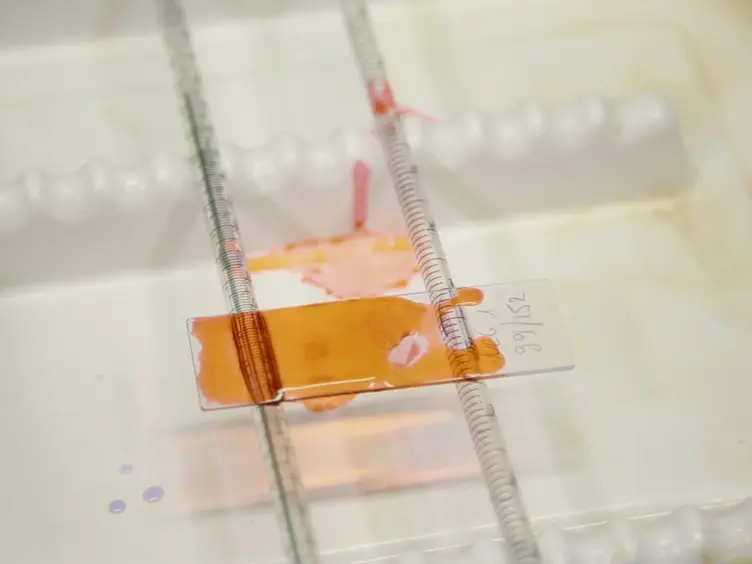 Tissue Characterization after a New Disaggregation Method for Skin Micro-Grafts Generation