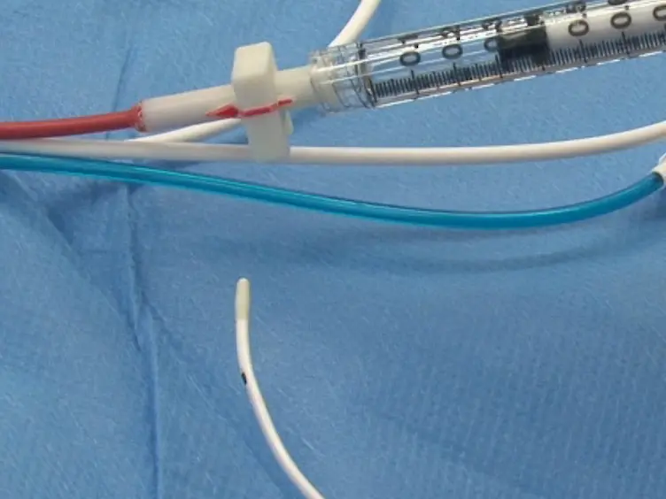 Lavage-induced Surfactant Depletion in Pigs As a Model of the Acute Respiratory Distress Syndrome (ARDS)