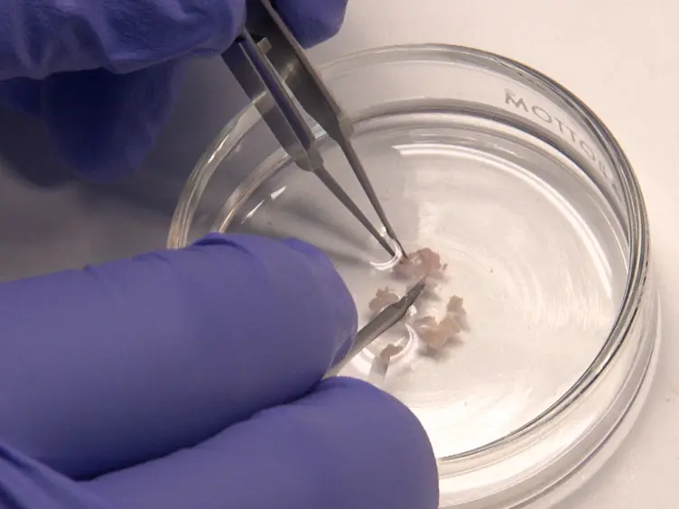 Three-dimensional Alginate-bead Culture of Human Pituitary Adenoma Cells