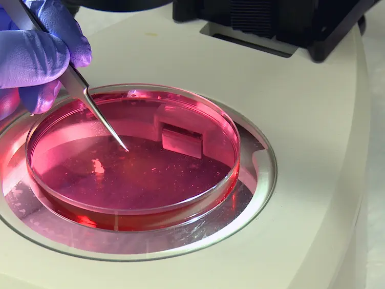 Epicardial Outgrowth Culture Assay and <em>Ex Vivo</em> Assessment of Epicardial-derived Cell Migration