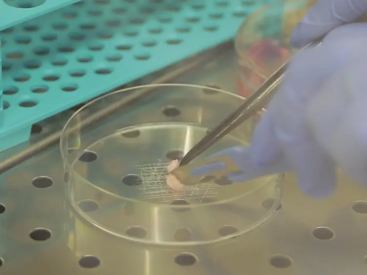 Establishment of Cancer Stem Cell Cultures from Human Conventional Osteosarcoma