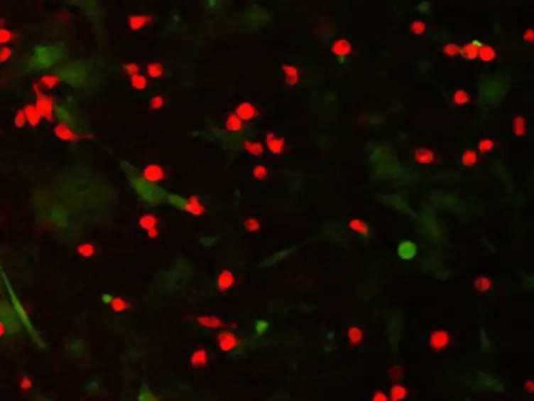 Coculture Assays to Study Macrophage and Microglia Stimulation of Glioblastoma Invasion
