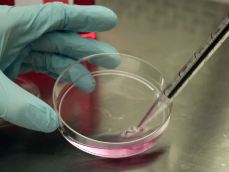 Injection of Syngeneic Murine Melanoma Cells to Determine Their Metastatic Potential in the Lungs
