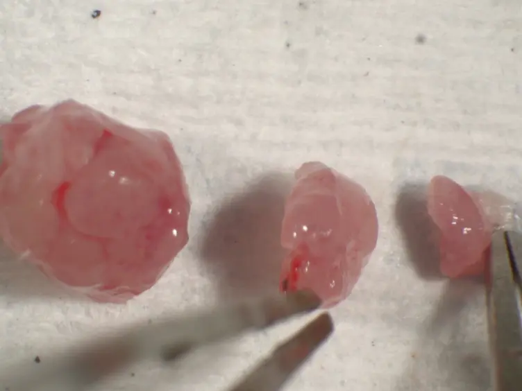 Myocardial Infarction in Neonatal Mice, A Model of Cardiac Regeneration