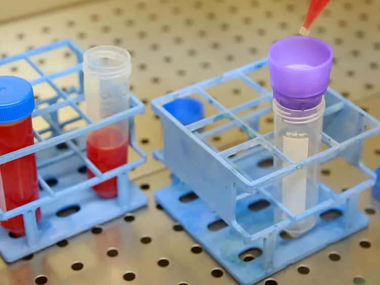 Isolating Mesangiogenic Progenitor Cells (MPCs) from Human Bone Marrow
