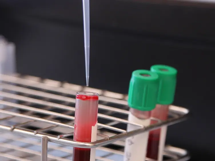 Measuring Granulocyte and Monocyte Phagocytosis and Oxidative Burst Activity in Human Blood