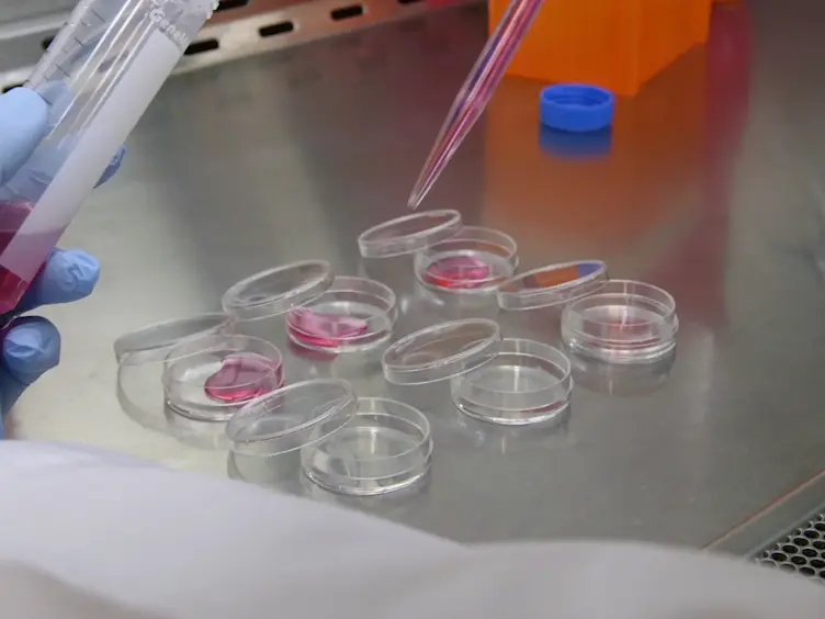 Assays for the Degradation of Misfolded Proteins in Cells