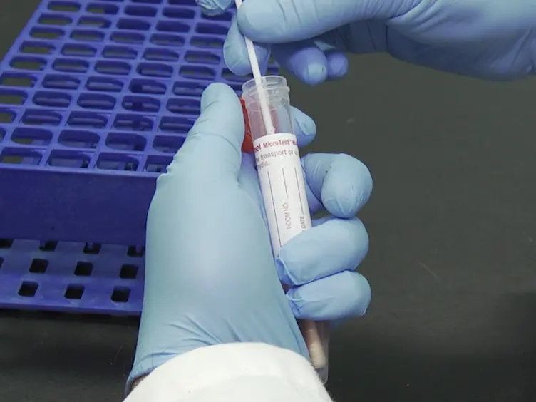Rapid Molecular Detection and Differentiation of Influenza Viruses A and B