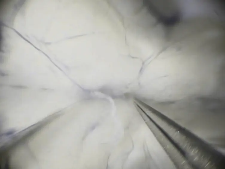 Protocol for Isolating the Mouse Circle of Willis