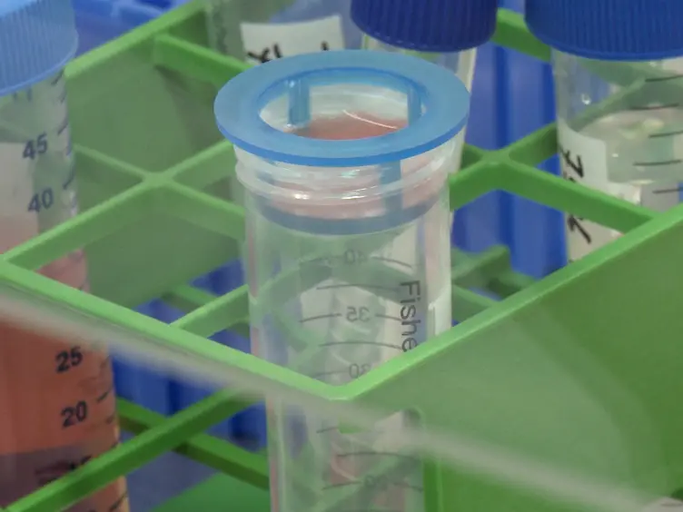 Generation of Induced Pluripotent Stem Cells from Human Melanoma Tumor-infiltrating Lymphocytes