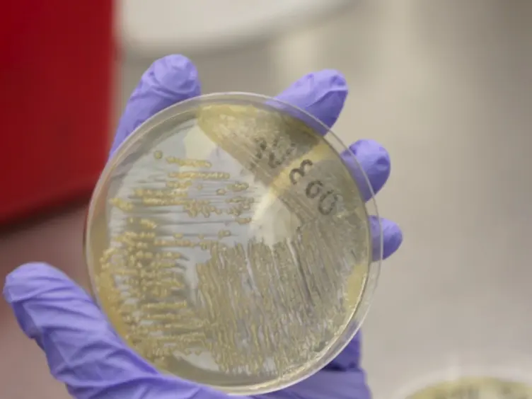 Development of a More Sensitive and Specific Chromogenic Agar Medium for the Detection of <em>Vibrio parahaemolyticus</em> and Other <em>Vibrio</em> Species