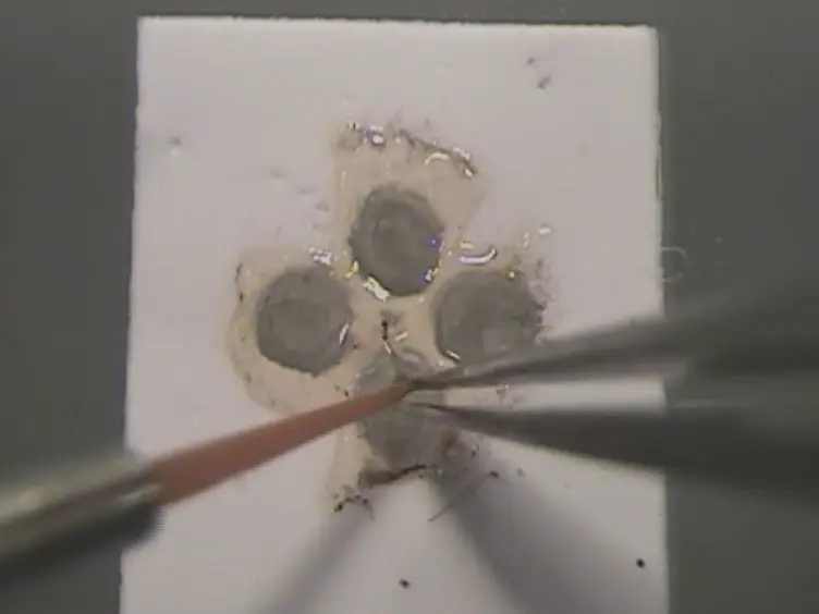 Patch Clamp Recording of Starburst Amacrine Cells in a Flat-mount Preparation of Deafferentated Mouse Retina