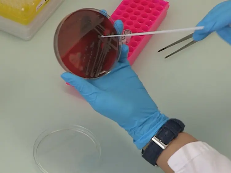 Genotyping of <em>Staphylococcus aureus</em> by Ribosomal Spacer PCR (RS-PCR)