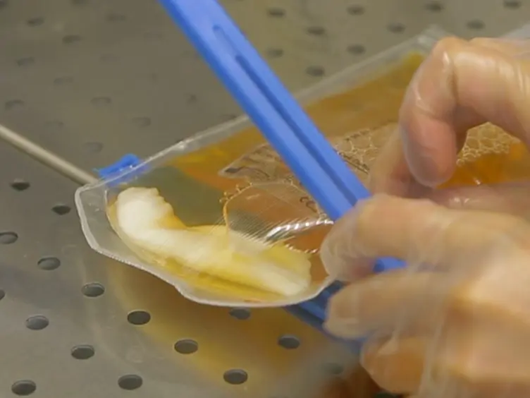 Mesenchymal Stromal Cell Culture and Delivery in Autologous Conditions: A Smart Approach for Orthopedic Applications