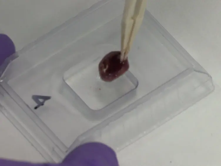 Histological Quantification of Chronic Myocardial Infarct in Rats