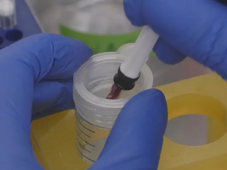 An Optimized Protocol to Analyze Glycolysis and Mitochondrial Respiration in Lymphocytes
