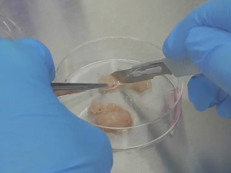 Labeling of Breast Cancer Patient-derived Xenografts with Traceable Reporters for Tumor Growth and Metastasis Studies