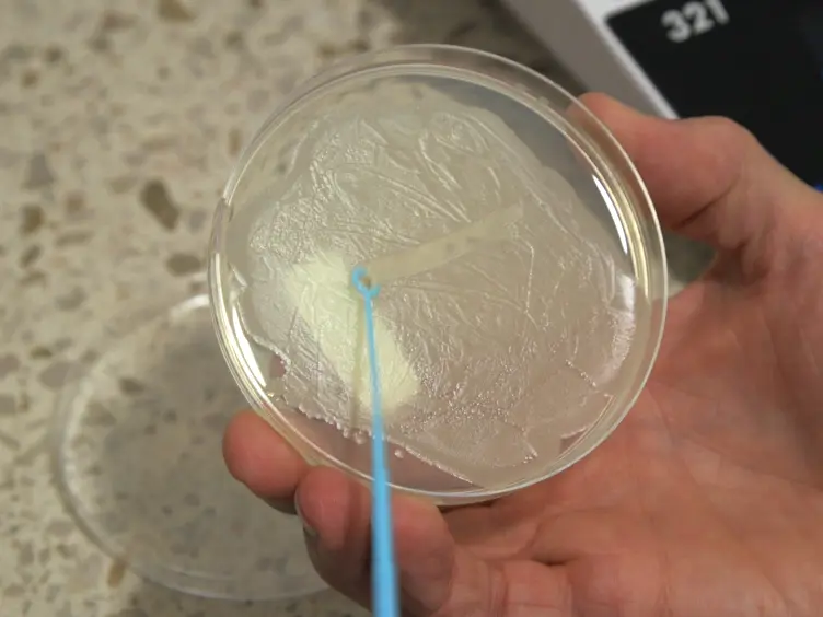 Identification of Fatty Acids in <em>Bacillus cereus</em>