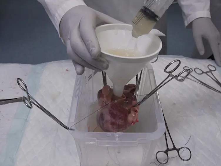 3D Whole-heart Myocardial Tissue Analysis