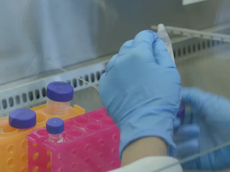 Low-Density Primary Hippocampal Neuron Culture