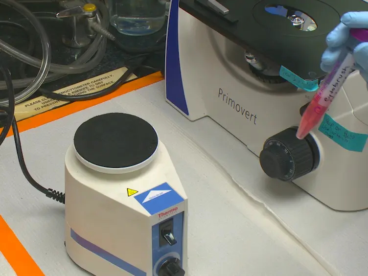 Isolation and Flow Cytometric Analysis of Human Endocervical Gamma Delta T Cells