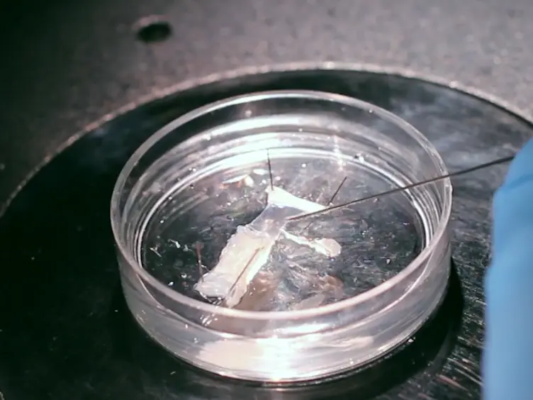 Loading a Calcium Dye into Frog Nerve Endings Through the Nerve Stump: Calcium Transient Registration in the Frog Neuromuscular Junction