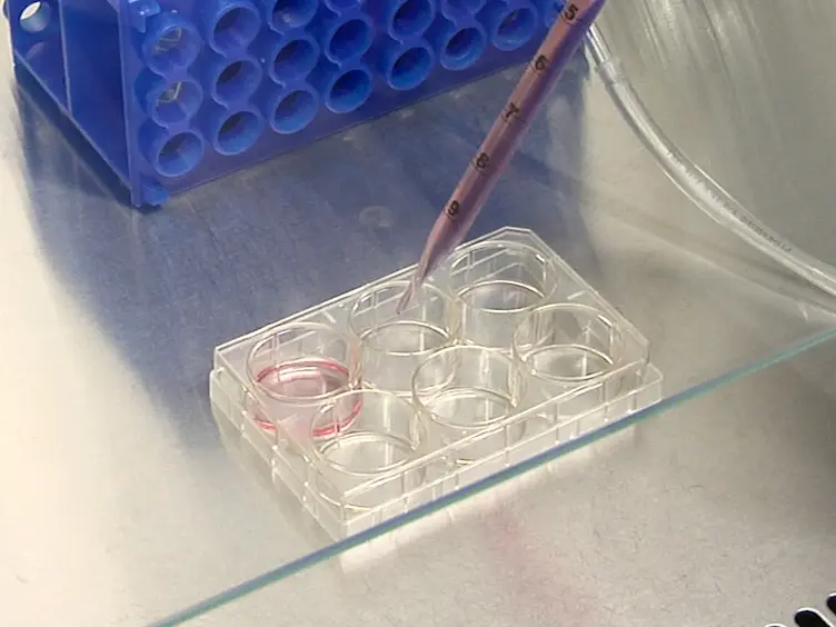 Pluripotent Stem Cell Derived Cardiac Cells for Myocardial Repair