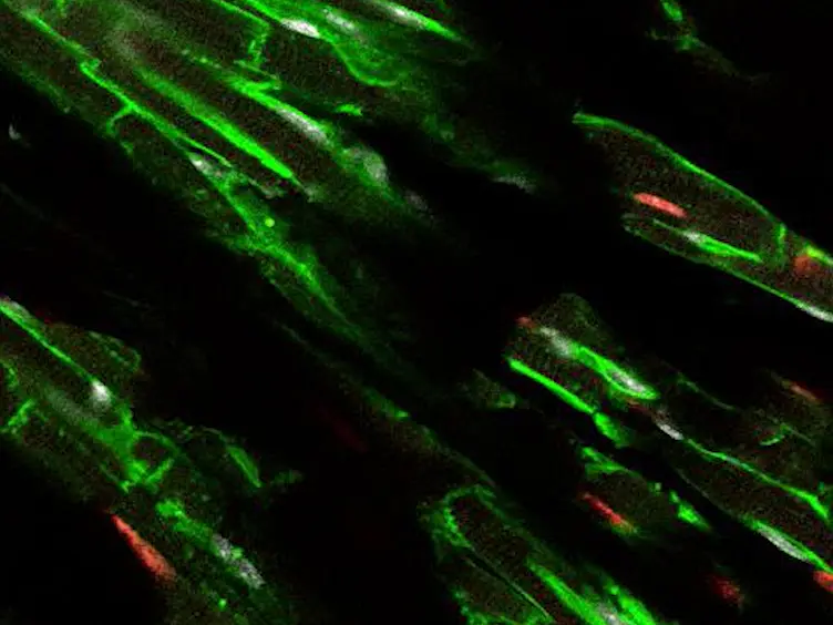 Visualization of Cell Cycle Variations and Determination of Nucleation in Postnatal Cardiomyocytes