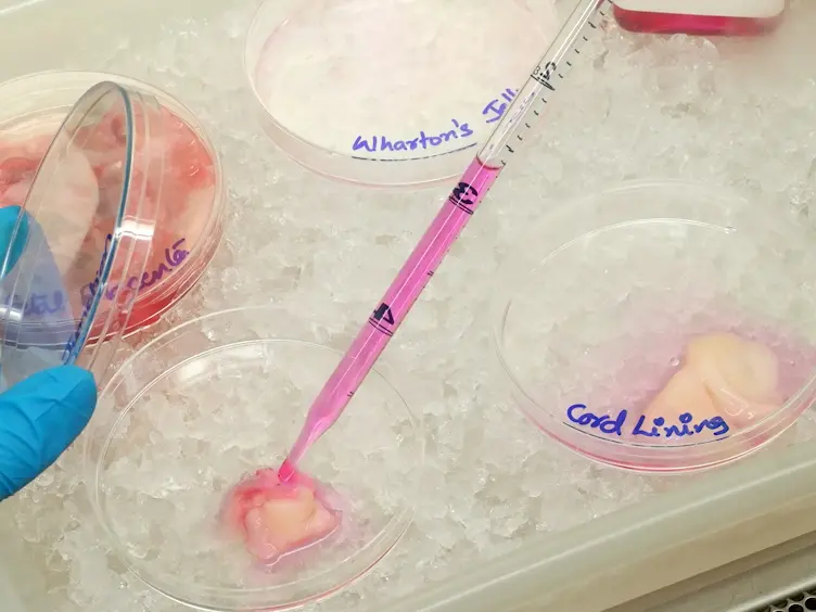 Isolation and Characterization of Mesenchymal Stromal Cells from Human Umbilical Cord and Fetal Placenta