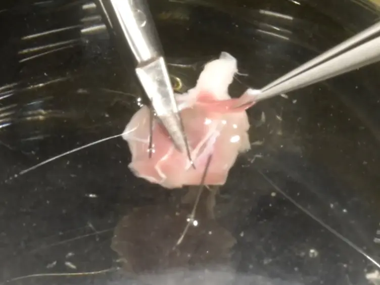 Measuring Neuromuscular Junction Functionality