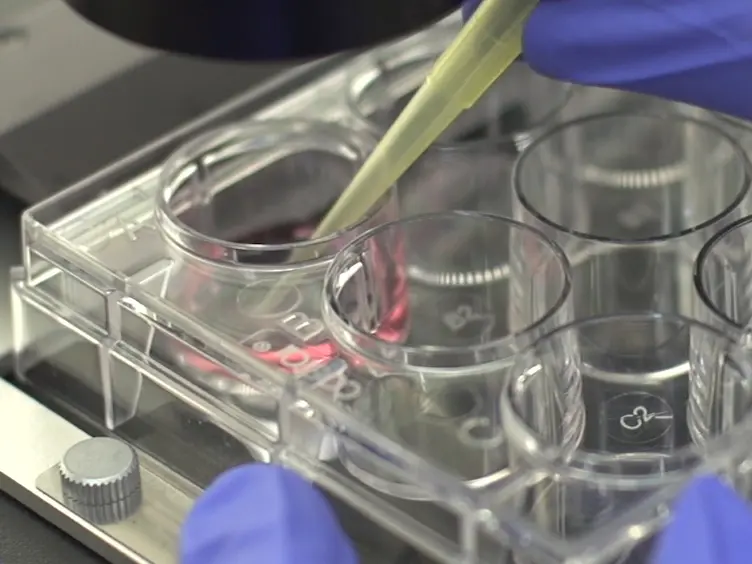 Small-scale Propagation of Human iPSCs in Serum-free Conditions for Routine Immunocytochemical Characterization