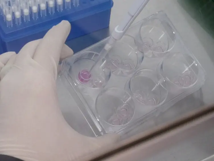 A Rapid Filter Insert-based 3D Culture System for Primary Prostate Cell Differentiation