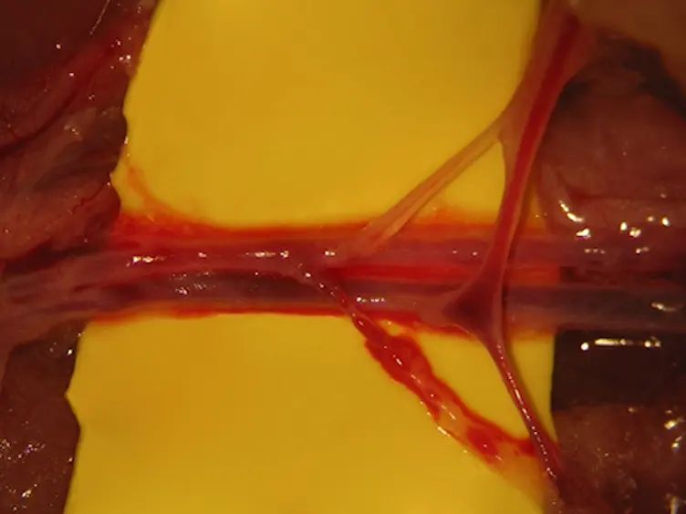 A Model of Free Tissue Transfer: The Rat Epigastric Free Flap