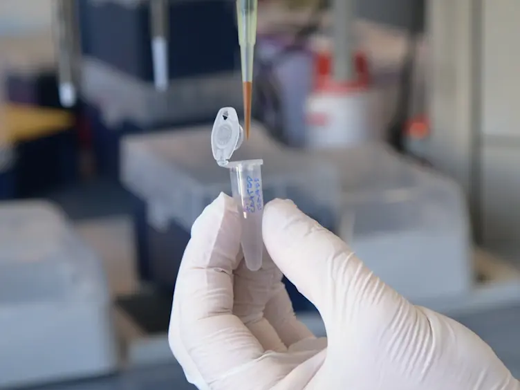 Analyzing Cell Surface Adhesion Remodeling in Response to Mechanical Tension Using Magnetic Beads