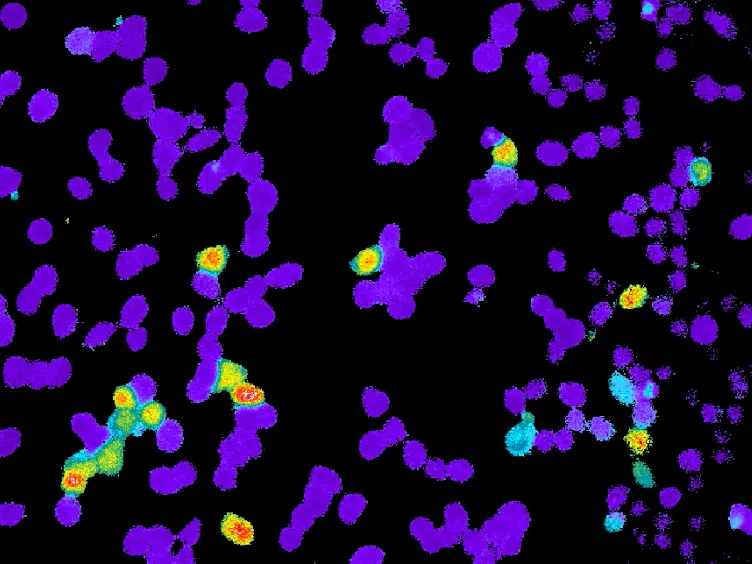 Controllable Ion Channel Expression through Inducible Transient Transfection