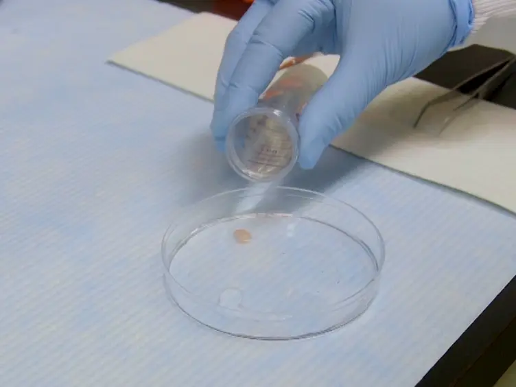 Preparation of Meiotic Chromosome Spreads from Mouse Spermatocytes