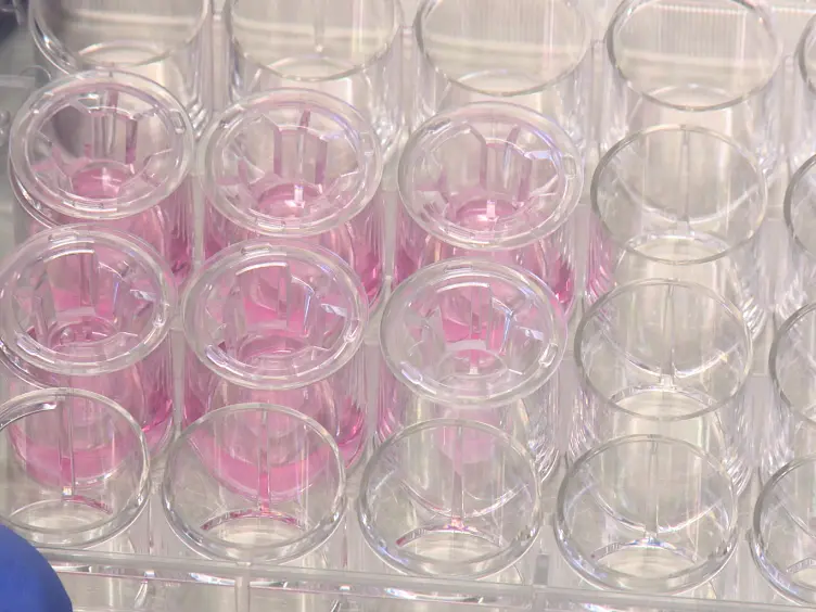 Analysis of Lymphocyte Extravasation Using an <em>In Vitro</em> Model of the Human Blood-brain Barrier