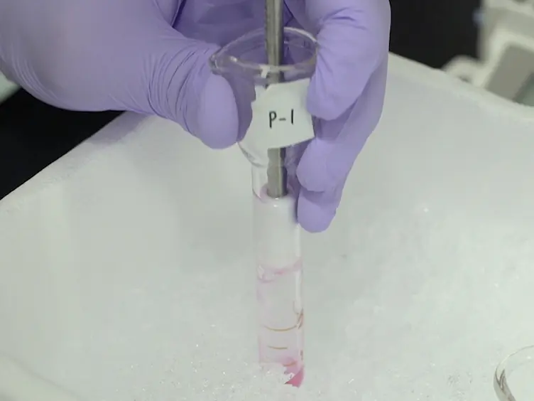 Detection of microRNA Expression in Peritoneal Membrane of Rats Using Quantitative Real-time PCR