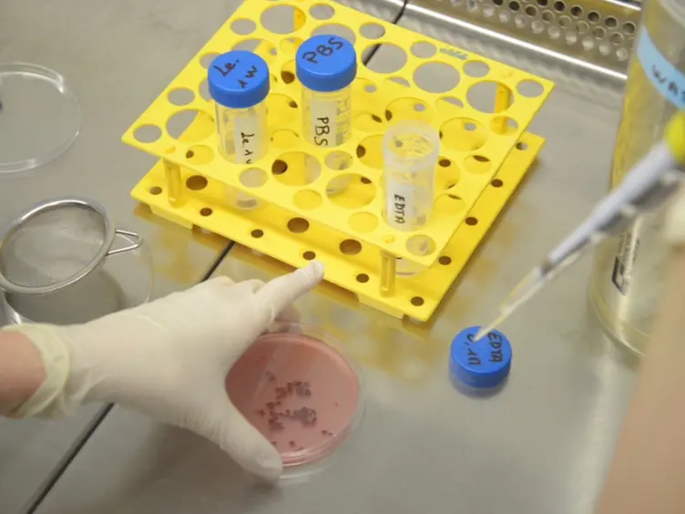 <em>In Vitro</em> and <em>In Vivo</em> Assessment of T, B and Myeloid Cells Suppressive Activity and Humoral Responses from Transplant Recipients