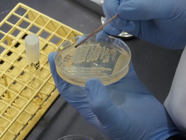 A Tandem Liquid Chromatography&#8211;Mass Spectrometry-based Approach for Metabolite Analysis of <em>Staphylococcus aureus</em>