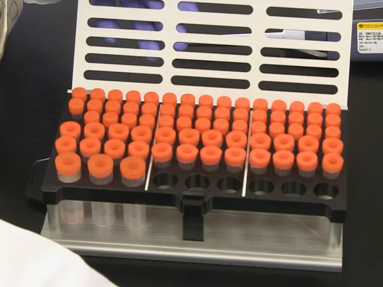 Determination of High-affinity Antibody-antigen Binding Kinetics Using Four Biosensor Platforms