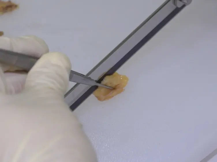 Protocol for HER2 FISH Using a Non-cross-linking, Formalin-free Tissue Fixative to Combine Advantages of Cryo-preservation and Formalin Fixation