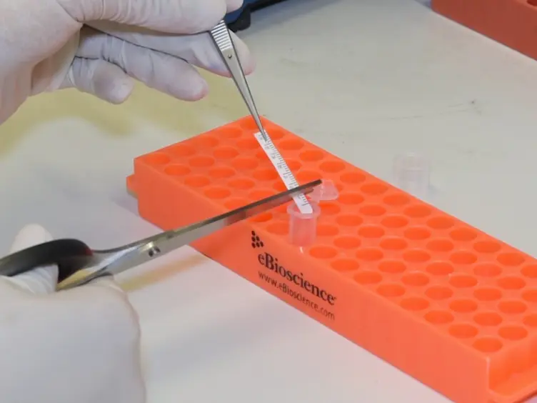 Bead Based Multiplex Assay for Analysis of Tear Cytokine Profiles