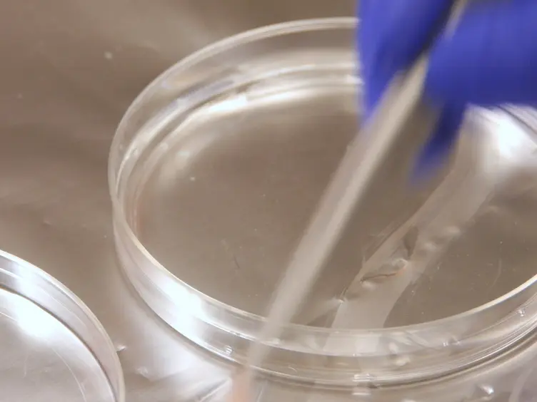 Isolation and Culture of Primary Mouse Keratinocytes from Neonatal and Adult Mouse Skin