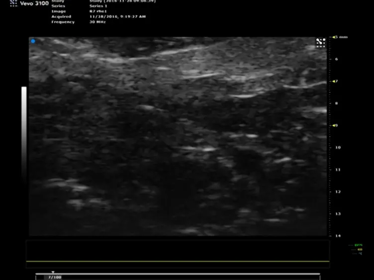 Ultrasonography in Experimental Reproductive Investigations on Rats