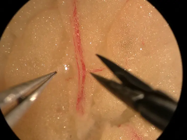Assessment of Human Adipose Tissue Microvascular Function Using Videomicroscopy