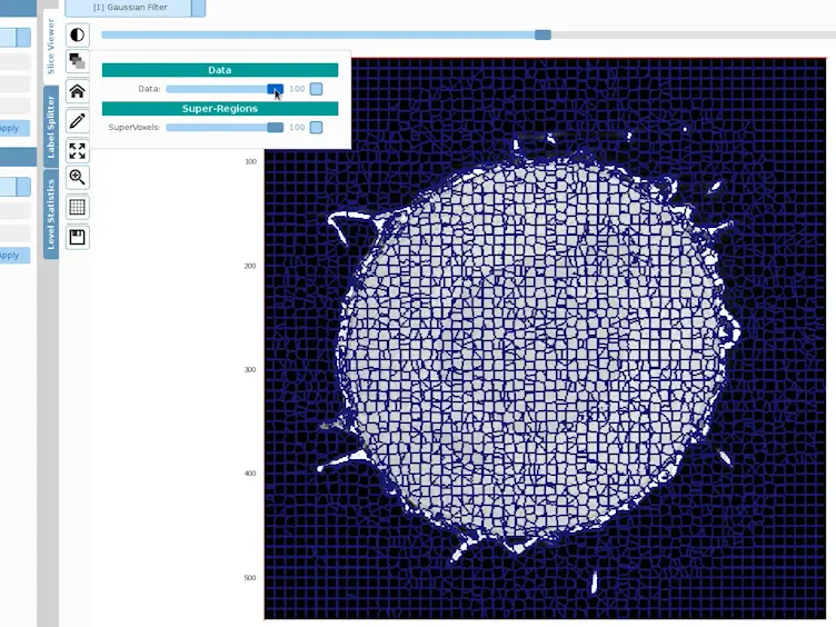 Volume Segmentation and Analysis of Biological Materials Using SuRVoS (Super-region Volume Segmentation) Workbench