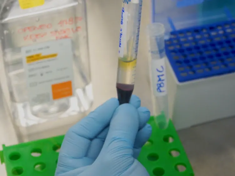 A Flow Cytometry-Based Cytotoxicity Assay for the Assessment of Human NK Cell Activity