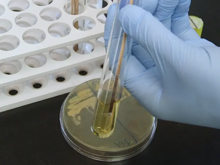 Measuring mRNA Levels Over Time During the Yeast <em>S. cerevisiae</em> Hypoxic Response