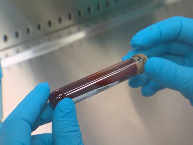 Detection of Rare Mutations in CtDNA Using Next Generation Sequencing